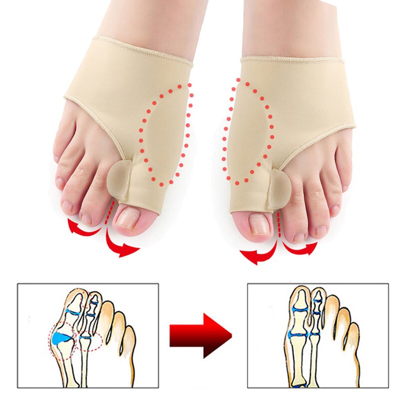 Toe Separator Hallux Valgus Bunion Corrector 